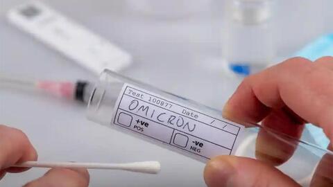 Thủ tướng Chính phủ yêu cầu thông tin chính thức, công khai về kit xét nghiệm