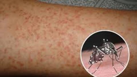 Hà Nội: Giảm số ca, thu hẹp địa bàn mắc sốt xuất huyết