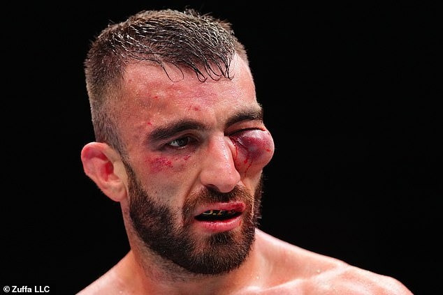 Nguyen đã khiến võ sĩ Yahya bị biến dạng mắt khủng khiếp trong trận đấu tại UFC Abu Dhabi tối 26/7. vo-si.jpg